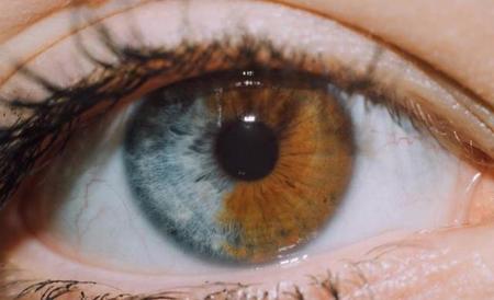 人的眼睛有几种颜色(紫罗兰色的眼睛)