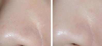 毛孔收敛水的正确步骤(毛孔收缩水怎么使用)