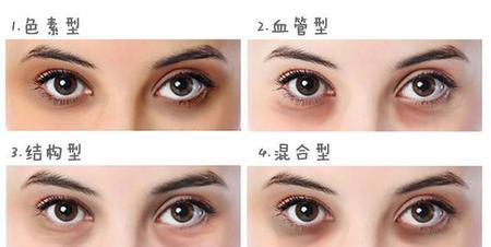 眼霜真能淡化黑眼圈吗(熬夜黑眼圈用什么眼霜效果好)