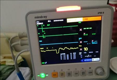 癌症晚期器官衰竭为什么不痛了