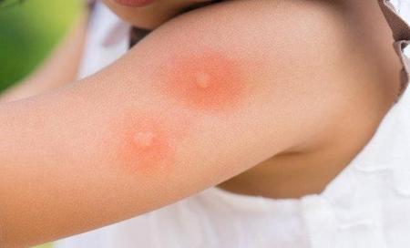 婴儿可以用蚊香片吗(婴儿专用电蚊香)