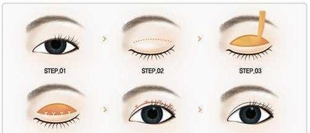 双眼皮手术为什么要开眼角(眼科医生不建议割双眼皮)