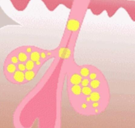 如何分辨干皮油皮混合皮(混干皮和混油皮区别肤质)