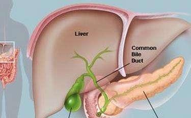 胆囊作用切除后对身体是否有影响(请问胆囊切除对身体有什么影响有后遗症吗)