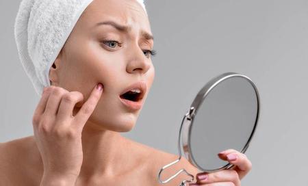 怎么祛痘?(怎样祛痘痘最有效的方法)