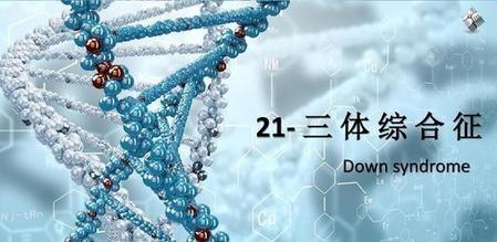 唐氏综合症生孩子遗传吗(唐氏综合症遗传吗)