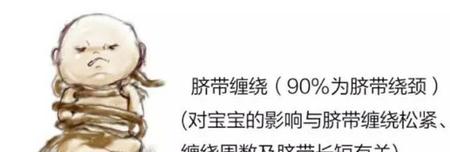 婴儿在肚子里脐带绕到脖子怎么办?(脐带绕颈两周顺产)