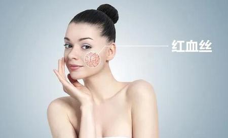 有什么办法去红血丝(红血丝是毛细血管破裂吗)