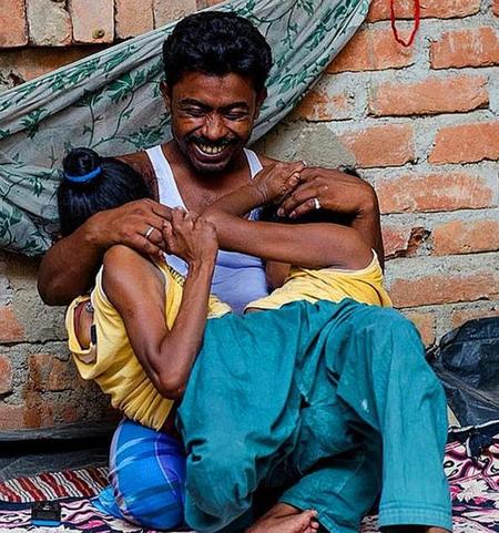 连体婴儿结婚生子