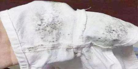 镜头霉斑怎么去除(单反相机镜头霉斑怎么处理)